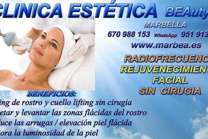 RADIOFRECUENCIA MARBELLA REJUVENECIMIENTO FACIAL y CORPORAL SIN CIRUGIA, TRATAMIENTO PARA EL ACNÉ - LA RADIOFRECUENCIA FACIAL