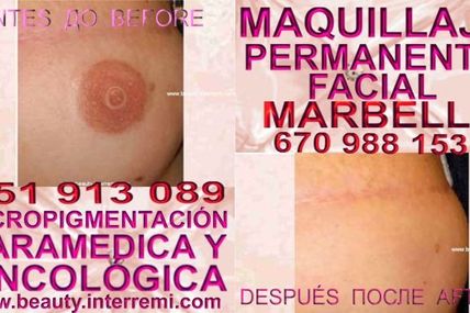 DERMOPIGMENTACION ,DERMOPIGMENTACION CICATRICES ,