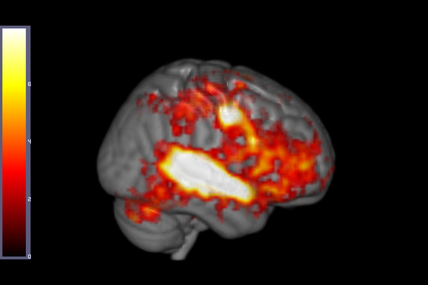 Premiers résultats d'une collaboration en neurosciences