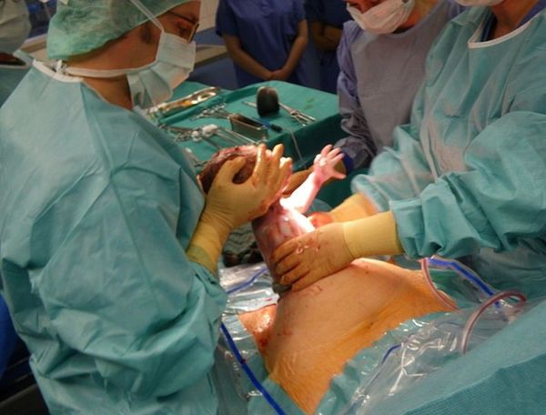 Santé (Algérie) : La Césarienne fait trembler les futures mamans