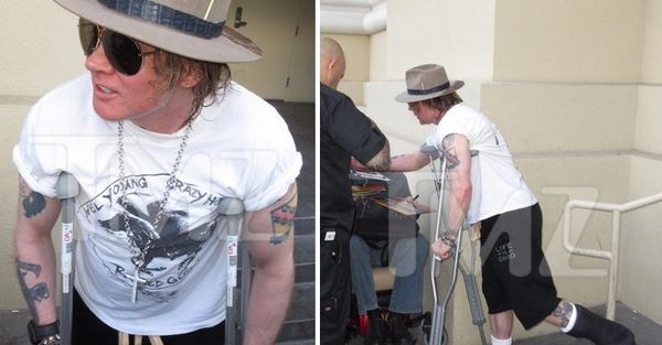 Axl Rose se casse le pied à l'aube de la tournée "Not in This Lifetime"