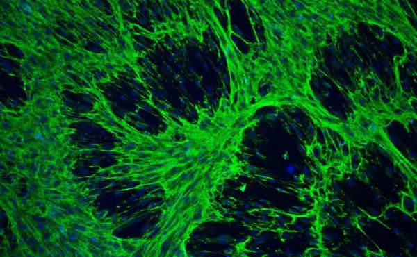 BioCare marine des "pansements intelligents et innovants" à base de biomolécules marines