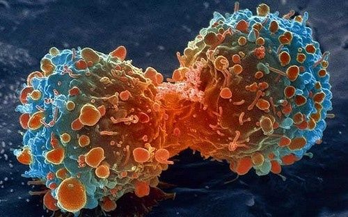 Le Carême : une prévention active du cancer