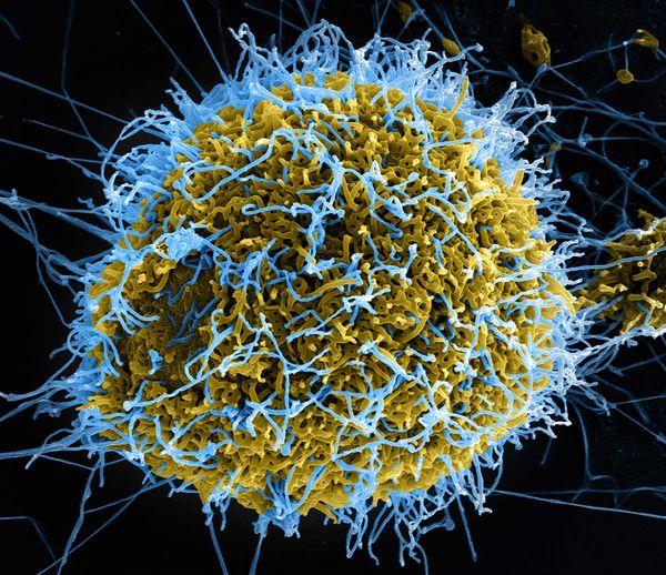 Ebola-Partikel Quelle:National Science Foundation