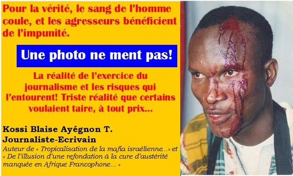 Le libre exercice du journalisme sous Faure Gnassingbé reste un leurre