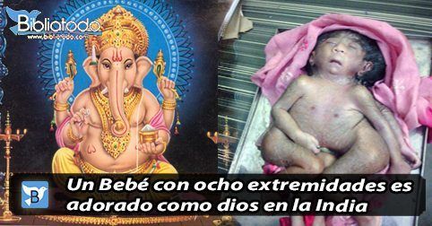 FOTO DE BEBE CON OCHO ESTREMIDADES QUE HA SIDO ADORADO EN LA INDIA