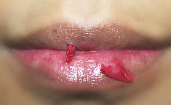 Bricolage - Incroyable Natural Lip masque pour les lèvres pigmentés