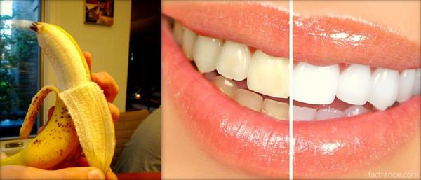 peau de banane= dents blancs