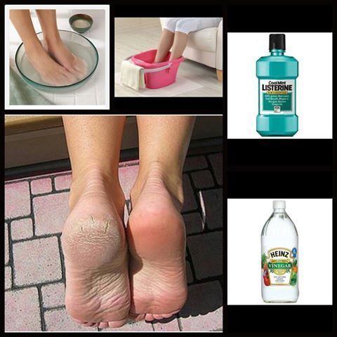 Pas aussi simple que ça pour avoir de jolis pieds