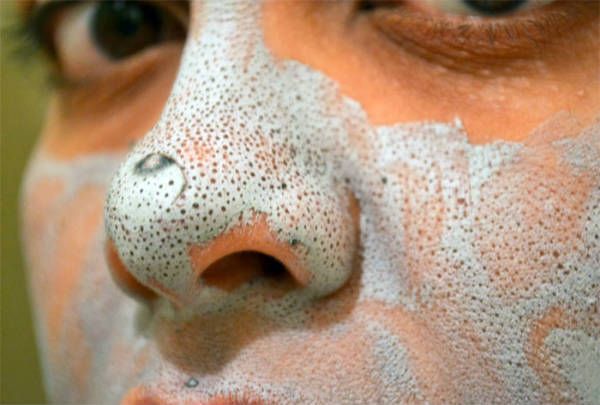 Le remède le plus efficace pour les points noirs: Seulement 5 minutes pour une peau lisse et propre!