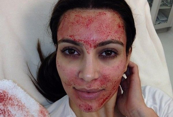 Masque visage fait maison au fraise et miel