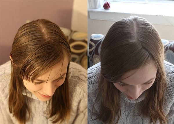 Elle n’a pas utilisé de shampoing pendant 6 mois. Le résultat est impressionnant !