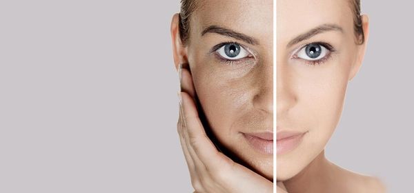 9 efficaces remèdes maison pour pores de la peau