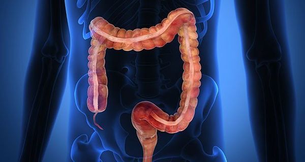 Vous pouvez avoir 20 kg de toxines dans vos intestins. Voici ce que vous pouvez faire ...