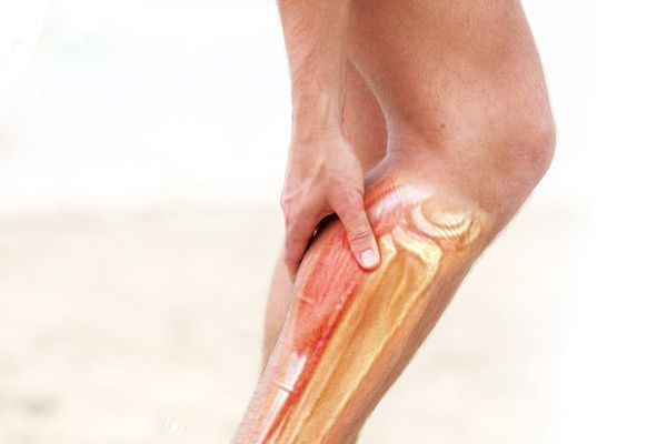 Comment guérir les crampes aux jambes, et ne jamais plus en avoir !