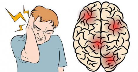 comment arrêter instantanément une migraine avec du sel?