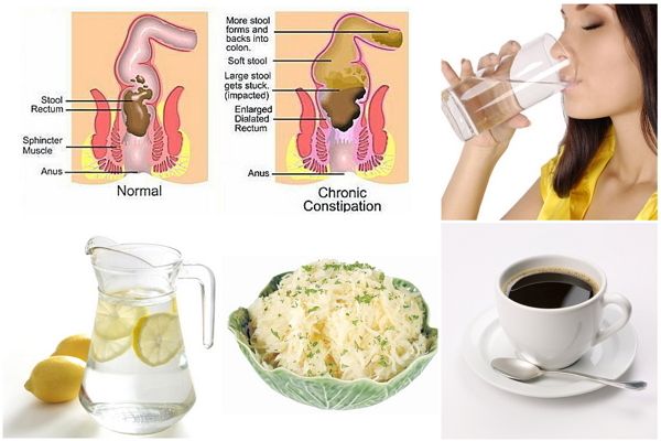 Conseils simples pour soulager la constipation - Astuces Conseils simples pour soulager la constipation - Astuces