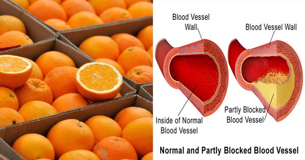 ÉTUDE RÉVÈLE QUE LA VITAMINE C EST ESSENTIELLE POUR LA PERTE DE POIDS ET POUR UNE PRESSION ARTÉRIELLE SAINE