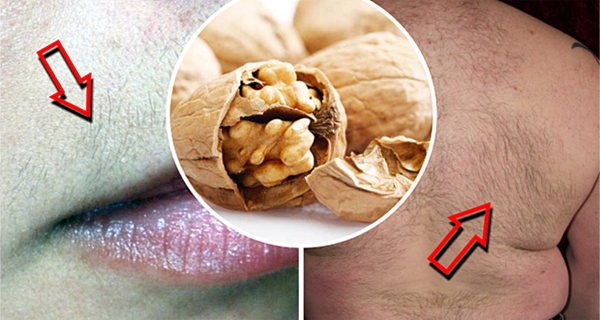 Recette étonnante - aide à éliminer les cheveux du visage et du corps