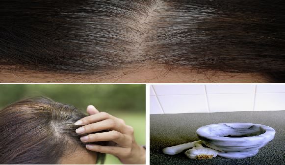 Ça ne prend que 5 minutes pour éliminer les Cheveux blancs