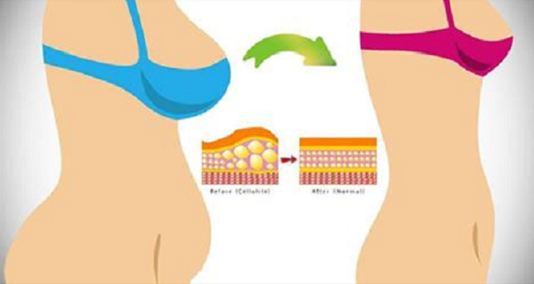 6 façons de perdre la graisse du ventre sans faire d'exercice.