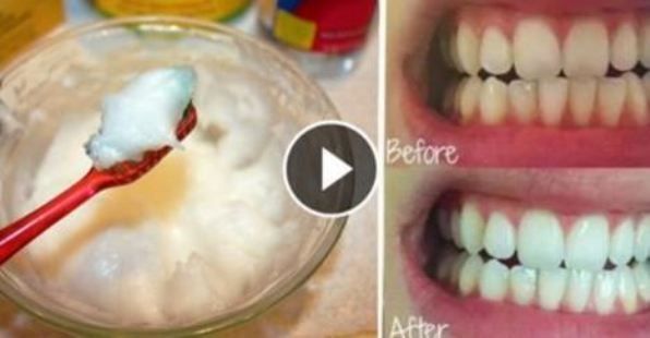 Experts disent que cette huile est mieux que votre dentifrice! Incroyable!