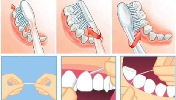 Traitez vos dents comme un dentiste: trucs simples pour enlever le tartre, la plaque, les bactéries et guérir la mauvaise haleine