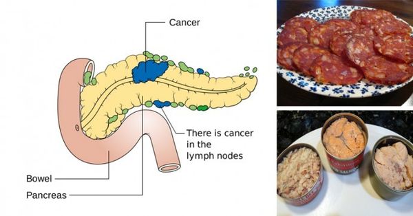14 aliments qui causent cancer et que vous devriez jamais mettez dans votre bouche dès maintenant