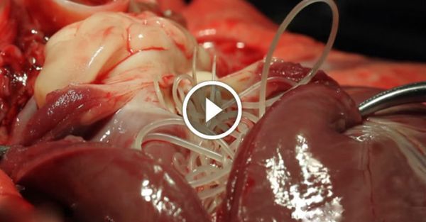 Voilà ce qui arrive dans votre corps quand vous mangez du porc ( vidéo )