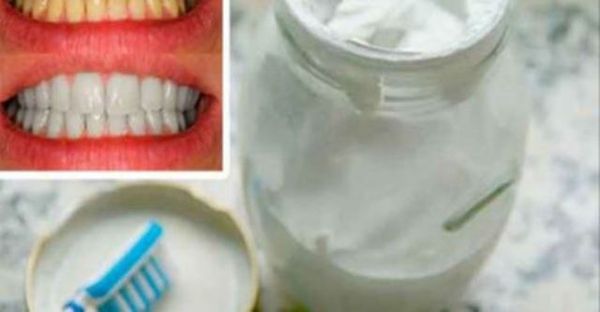 Dites Adieu À La Mauvaise Haleine, Le Tartre Et La Plaque Avec Ce Dentifrice Fait Maison