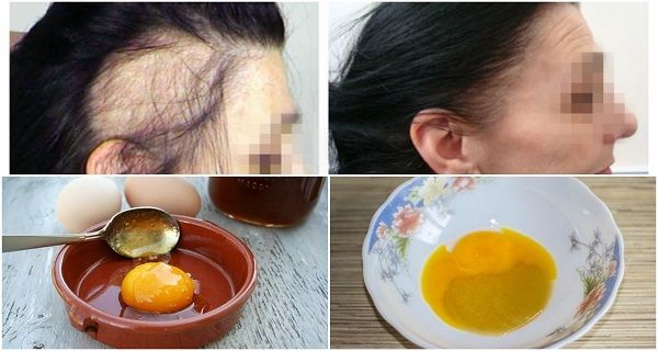 La recette magique pour le plus rapide croissance des cheveux! avec seulement 3 ingrédients