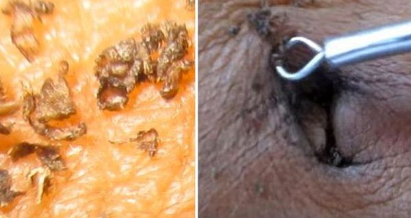 CECI EST LA PARTIE DU CORPS LA PLUS SALE! VOICI COMMENT LE NETTOYER DE GERMES ET DE BACTÉRIES POUR PRÉVENIR LES MALADIES