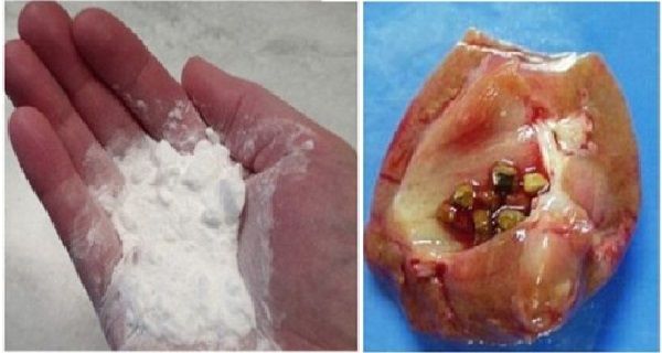 Comment faire pour réparer vos reins naturellement à l'aide de bicarbonate de soude