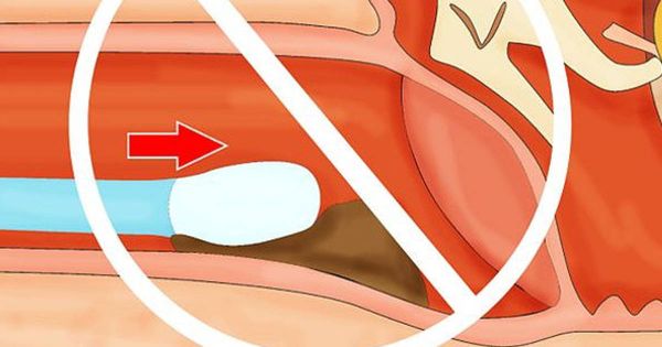 Voici Pourquoi Vous Ne Devez Jamais nettoyer vos Oreilles Avec Un batonnet