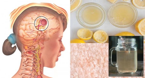 Boisson naturelle qui fait que votre migraine disparaît en seulement 10 minutes!