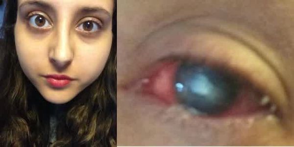 Pour ceux qui portent des lentilles de contact:faites attention !!!!