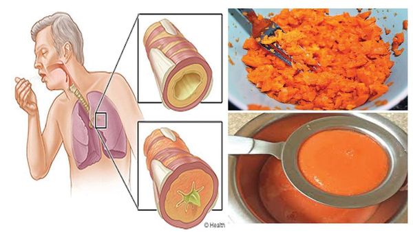 Efficacité prouvée: Ancien sirop fait maison qui élimine le mucus des poumons et guérit la toux !