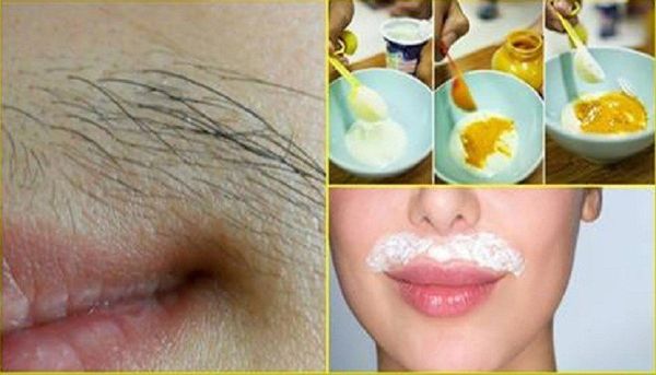 Mesdames: Cela peut aider à vous débarrasser de Moustache et autres poils indésirables de votre corps pour toujours!