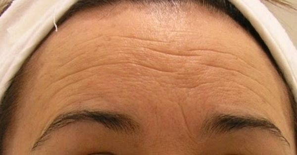 Ne vous étonnez pas et découvrez le meilleur remède naturel contre les rides à base de betterave et de carotte