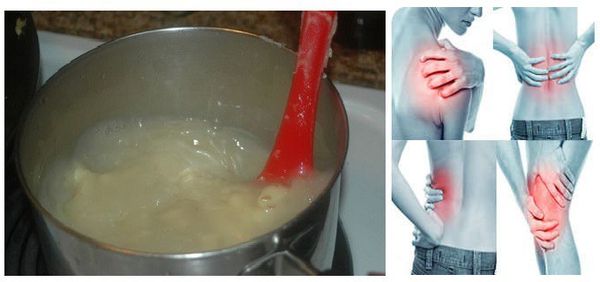 Cette recette est vraiment - un miracle! Il va guérir vos douleurs articulaires en une seule journée