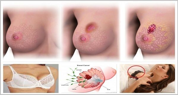 Les médecins conseillent aux femmes d’arrêter de porter des soutiens-gorge ! Voici pourquoi