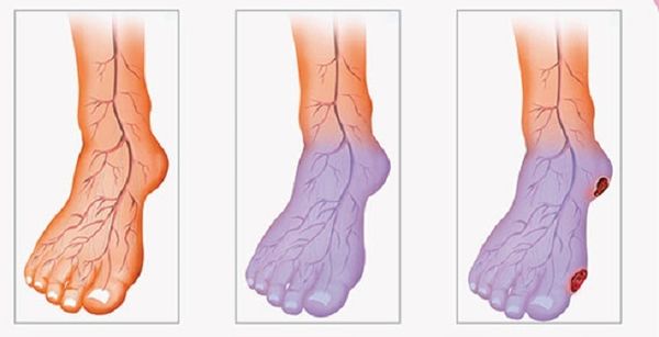 Une mauvaise circulation sanguine, jambes froides et mains? Voici ce que vous pouvez faire pour résoudre ce problème!