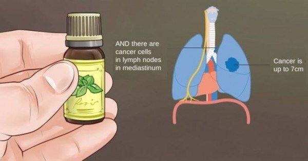 La vérité sur le cancer et les huiles essentielles: Qu'est ce que les oncologues ne veulent pas vous dire?