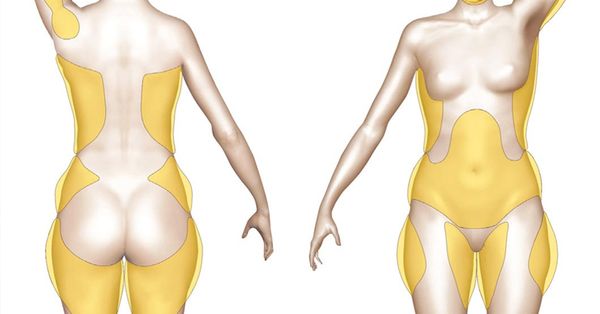 Perdre du poids naturellement et sans exercice Avec l'aide de ces astuces simples