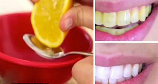 Incroyable: blanchir vos dents en 2 minutes avec l'aide de ces ingrédients