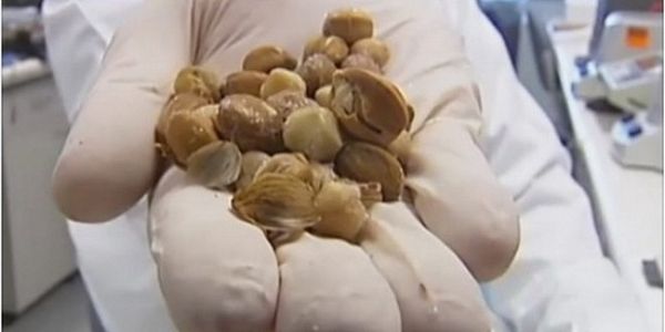 Incroyable découverte scientifique! Ce fruit détruit les tumeurs en quelques minutes (Vidéo)