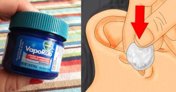 Il met une boule avec du Vicks VapoRub dans son oreille . Voici ce qui va se passer! et découvrez aussi les autres utilisations di vicks dans la VIDEO