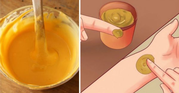 Voici ce qu'ils ont oublié de vous dire sur l'utilisation de Curcuma (pour la douleur, les coupures, les dents, la peau et plus)