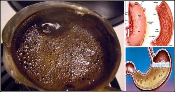 Important : Si vous buvez du café le matin à jeun, vous devez absolument lire cet article