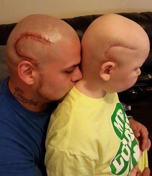 Une histoire touchante de la façon dont un père a soulevé l'humeur de son fils avec un tatouage en forme de la cicatrice de son fils!